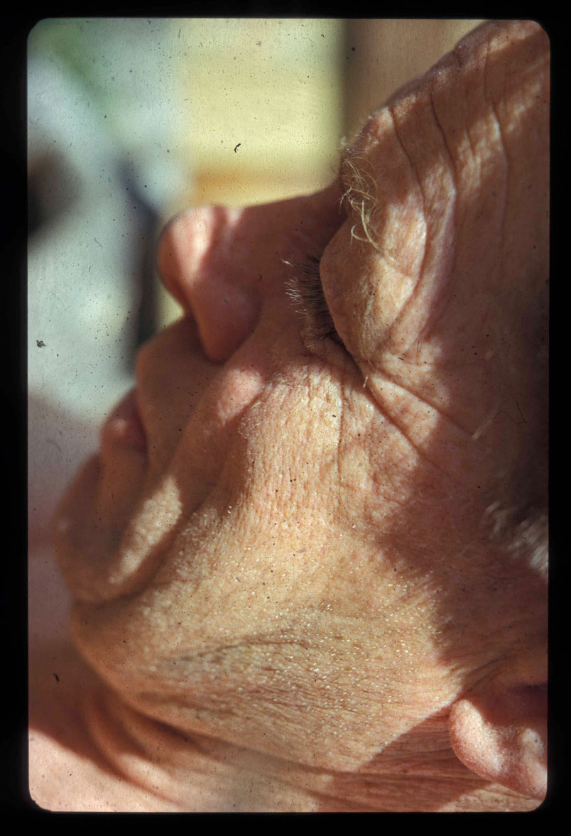 Glinning-narbild Glinning-narbild